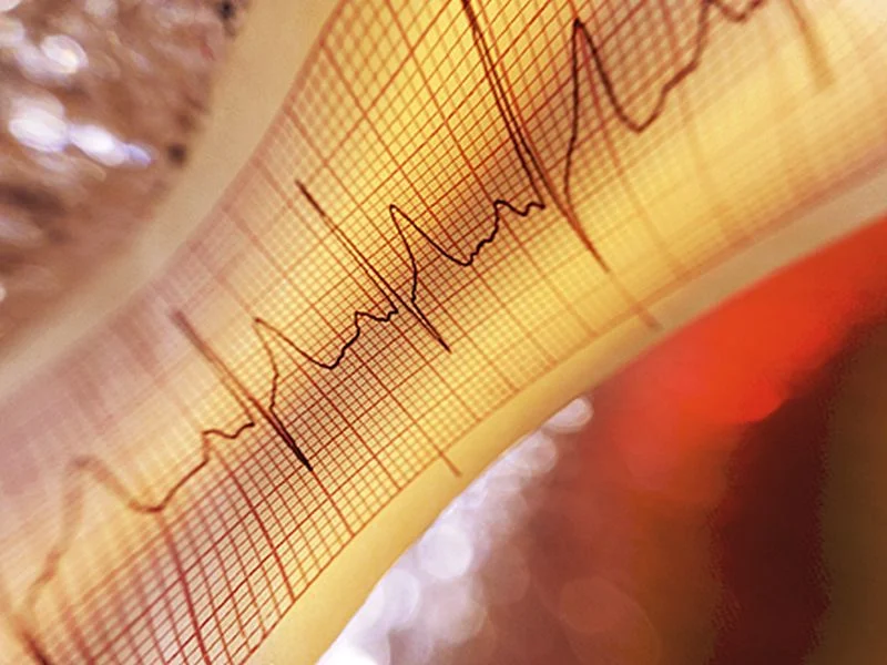 Image d'actualité : COVID peut augmenter les risques à long terme des battements cardiaques irréguliers
