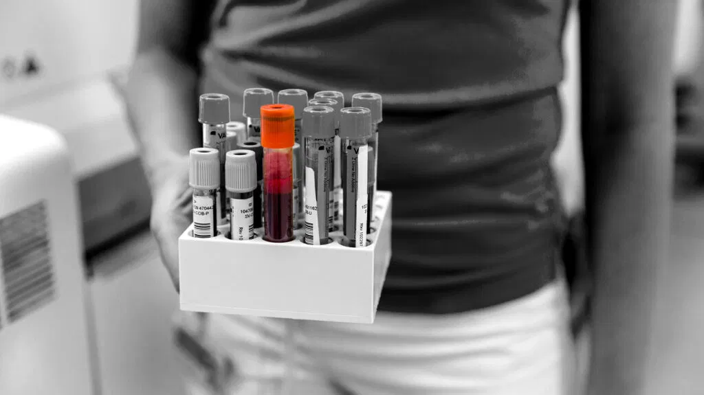 Une personne tenant des tubes d'échantillons de sang