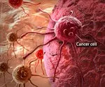 Comprendre le cancer: métastase, stades du cancer et plus encore