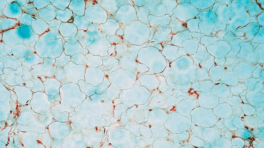Cellules adipeuses humaines vues au microscope