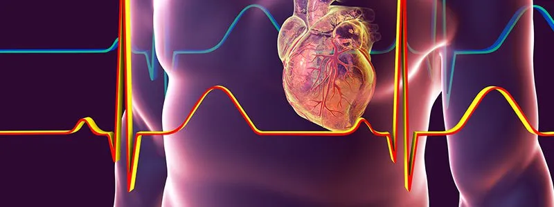 Image : Maladies cardiaques : Causes d'une crise cardiaque