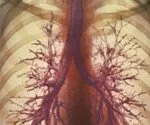 Symptômes, diagnostic et traitement des maladies pulmonaires obstructives chroniques