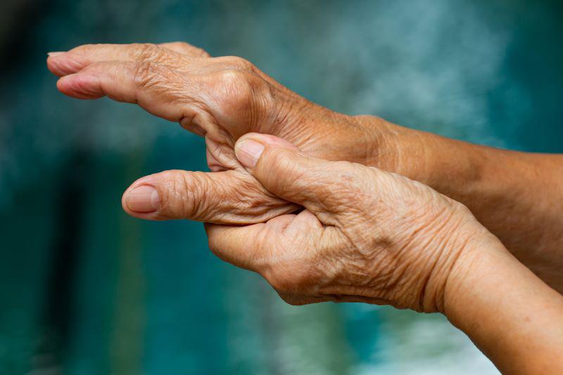 Immagine di notizie: Il farmaco usato per trattare l'artrite reumatoide potrebbe anche aiutare a prevenirla