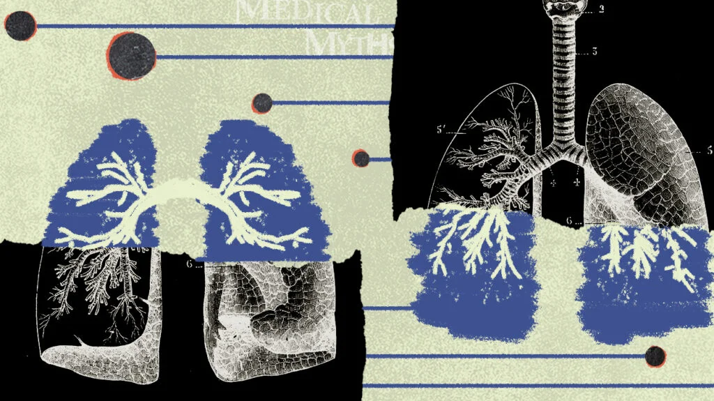 Logotipo de mitos médicos com imagens de exames de pulmão
